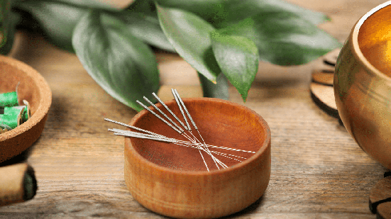 A acupuntura pode ser uma alternativa complementar para promover relaxamento e auxiliar no alívio da dor durante a rotina de estudos (Imagem: New África | Shutterstock)