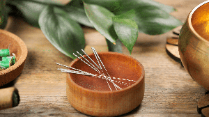 A acupuntura pode ser uma alternativa complementar para promover relaxamento e auxiliar no alívio da dor durante a rotina de estudos (Imagem: New África | Shutterstock)