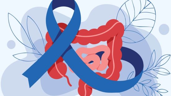 A atividade física é uma aliada contra o câncer colorretal (Imagem: Nasly creativity | Shutterstock)