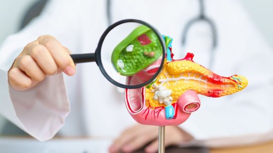 Sem tratamento adequado, a pedra na vesícula pode provocar novos episódios e levar a complicações mais graves (Imagem: Jo Panuwat D | Shutterstock)