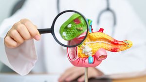 Sem tratamento adequado, a pedra na vesícula pode provocar novos episódios e levar a complicações mais graves (Imagem: Jo Panuwat D | Shutterstock)