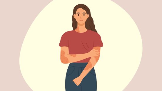 A psoríase vai além da pele e pode afetar articulações, unhas e a qualidade de vida dos pacientes (Imagem: lanastace | Shutterstock)