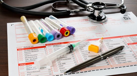 Os exames de sangue, fezes e urina são essenciais para identificar alterações no organismo (Imagem: Henrik Dolle | Shutterstock)