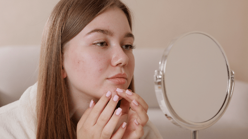 Sua pele piorou depois do skincare? 5 erros que podem causar oleosidade, irritação e espinhas