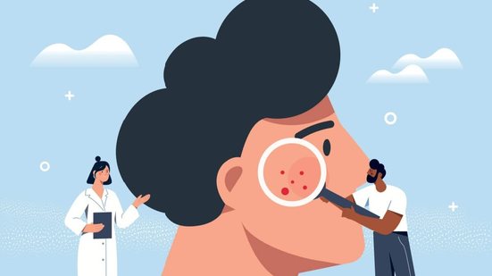 O câncer de pele é uma doença silenciosa e agressiva (Imagem: mentalmind | Shutterstock)