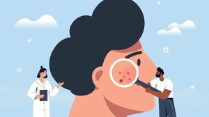 O câncer de pele é uma doença silenciosa e agressiva (Imagem: mentalmind | Shutterstock)