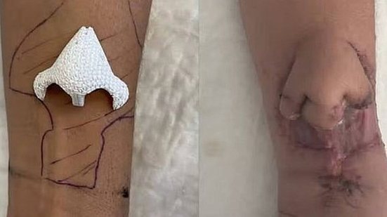 Foto: Reprodução/CHU