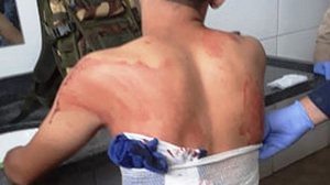 Rapaz foi liberado com grave ferimento feito a faca | PM-MT