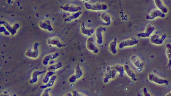 Foto: Reprodução/CDC