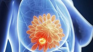 Sociedade Brasileira de Mastologia