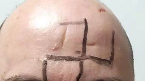 Imagem Homem é agredido e tem suástica desenhada na testa em ataque em MG