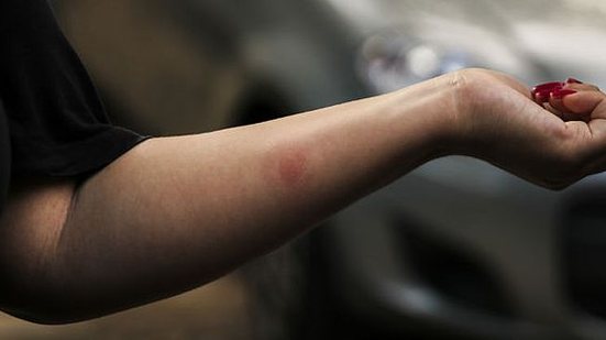 Marcas da agressão | Tarciso Augusto/Esp.DP.