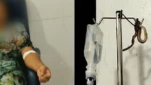 Imagem Cobra cai do teto de posto de saúde e assusta paciente ao ficar em cima de suporte do soro