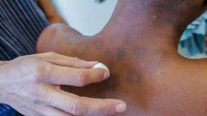 Foto: SMS de Mesquita