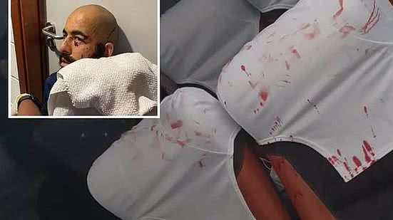 Imagem Jogador passará por cirurgia no olho após ataque com bomba ao ônibus do Bahia