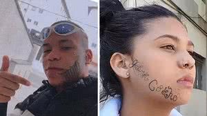 Imagem 'Me sinto livre', diz jovem ao iniciar remoção de tatuagem feita pelo ex-namorado