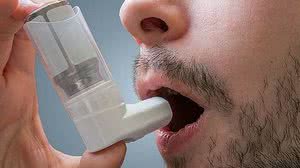 Foto: Reprodução / Internet