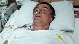 Jair Bolsonaro precisou fazer uma tomografia computadorizada de tórax e abdômen | Reprodução