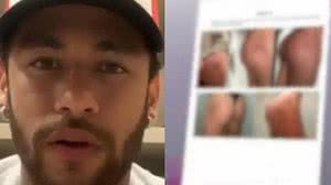 Imagem Caso Neymar: mulher apresenta novas fotos de suposta agressão