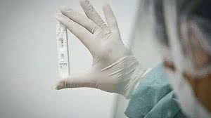 A confirmação consta no Relatório Epidemiológico 45, emitido pelo Ministério da Saúde (MS) | Foto: Reprodução