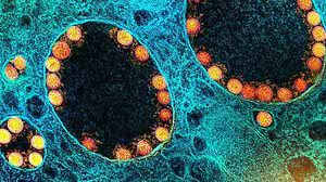 Foto: Instituto Nacional de Alergia e Doenças Infecciosas dos EUA