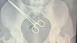 Foto: Reprodução/TV Tem