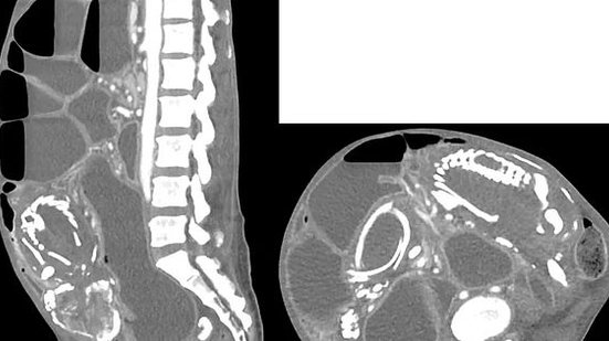 Foto: Reprodução/BMC Women's Health