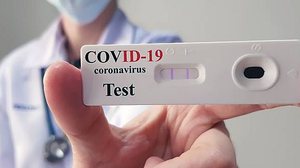 Imagem Brasil chega a 54,9 mil mortes e 1,22 milhão de casos, aponta MS