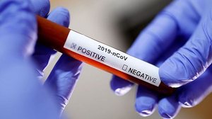 Imagem Coronavírus: adolescente de São Paulo está entre os novos infectados