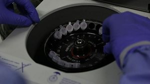 Imagem Genomas de coronavírus dos casos confirmados do país são diferentes