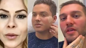 Imagem Harmonização facial: saiba tudo sobre o procedimento que virou 'moda' entre os famosos