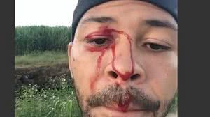 Reprodução / Twitter Daily Mail