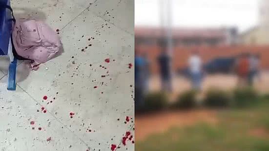 Aluno é baleado em escola estadual de Alagoas | Foto: Reprodução
