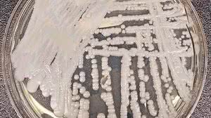 O fungo Candida auris ataca pessoas com seu sistema imunológico debilitado | Centers for Disease Control and Prevention via The New York Times