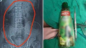 Reprodução / Redes SociaisSWNS