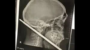 HSM / Prefeitura de Santarém / Divulgação