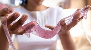 slime | Gettyimages
