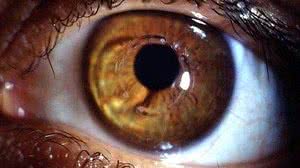 Fungo penetra na parte interna do olho, como tecidos, fluídos e estrutura | Paulo Ferrara / Agência Sebrae