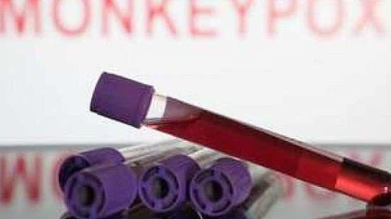 Foto: Reprdoução/Agência Brasil