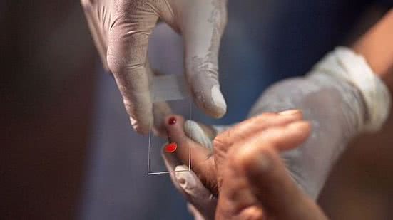 Em 2020, Brasil registrou 145.188 casos da doença que pode matar | Foto: Reprodução/Agência Brasil