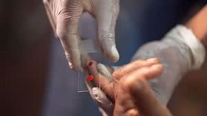 Em 2020, Brasil registrou 145.188 casos da doença que pode matar | Foto: Reprodução/Agência Brasil