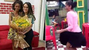 Imagem Após Madonna compartilhar vídeo, brasileira ganha tratamento em clínica de reabilitação