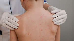 Divulgação/Secom Maceió