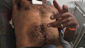 José Vicente Ribeiro | Divulgação/PC-PE