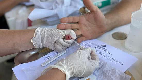 Testes de HIV são realizados em todas as unidades de saúde | Foto: Ascom SMS