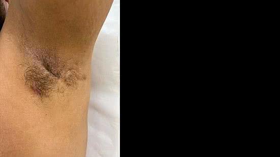 Wagner Galvão / Divulgação