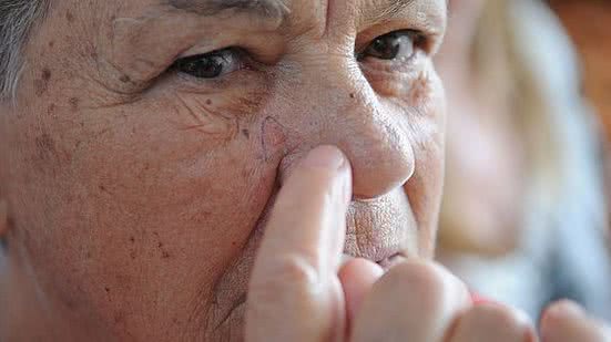 Câncer de pele | Fabio Rodrigues Pozzebom/Agência Brasil