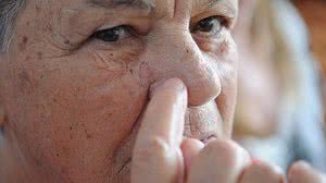 Câncer de pele | Fabio Rodrigues Pozzebom/Agência Brasil