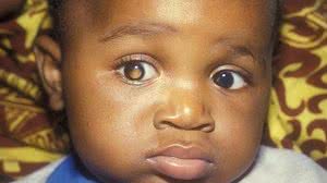 Foto: Reprodução/Pak Sang Lee