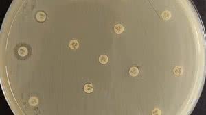 Foto: Reprodução/Rubens Renato Carmo-ICB-USP